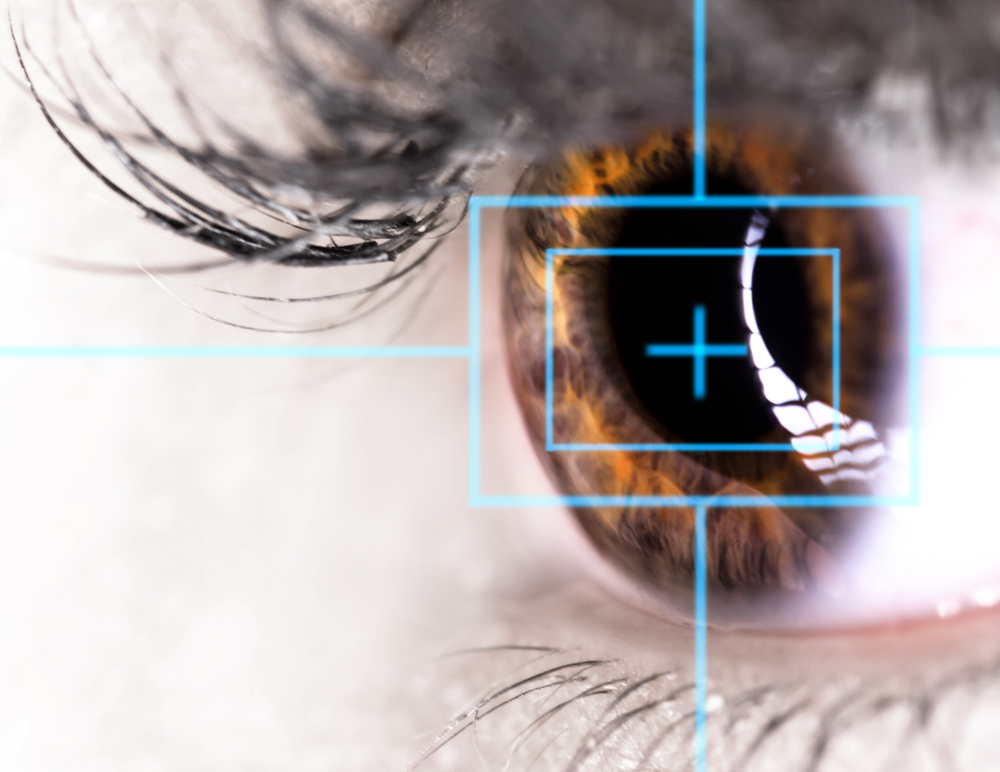 Qu'est-ce que la chirurgie refractive de l'oeil ?
