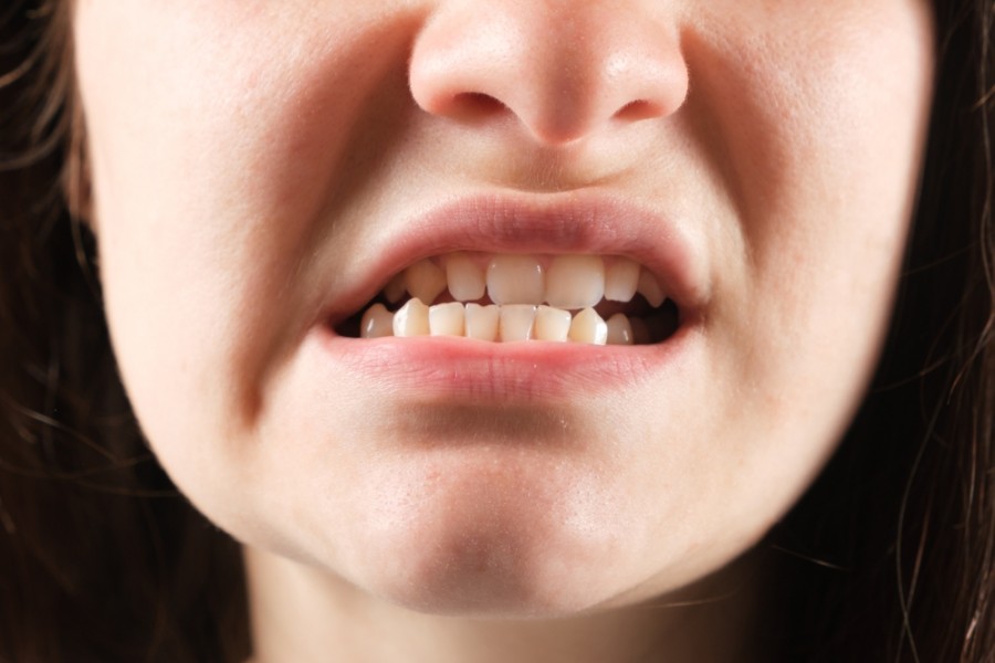 Comment se déroule un traitement parodontal ?