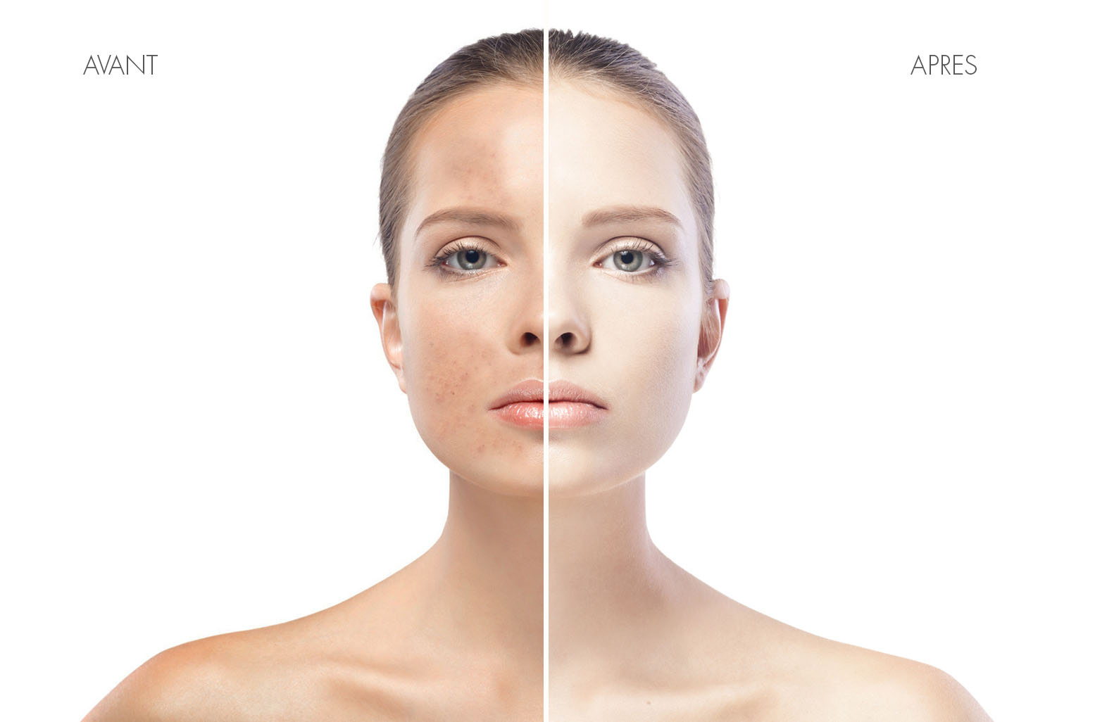 Les complexes sur notre visage, des solutions ?